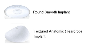 GUMMY BEAR IMPLANTS  THE ADVANTAGES OF FORM-STABLE IMPLANTS